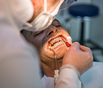 Dr. Daniel Cobb, Alex Bell Dental Image Of Gum Treatments