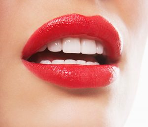 Dr. Daniel Cobb, Alex Bell Dental Image Of Pretty Lips