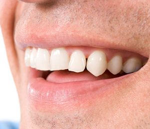 Dr. Daniel Cobb, Alex Bell Dental Describes what is TMJ & TMD