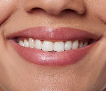 Dr. Daniel Cobb, Alex Bell Dental Image oF Smiling Woman