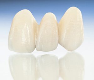 Dr. Daniel Cobb, Alex Bell Dental Image Of Teeth