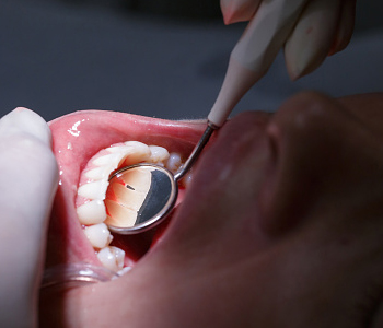 Dr. Daniel Cobb, Alex Bell Dental Describing How Bridge the gap of missing teeth with dental bridges in Centerville, OH