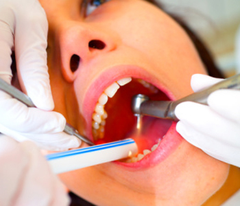 Dr. Daniel Cobb, Alex Bell Dental Image Dental Laser Treatment