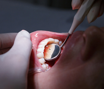 Dr. Daniel Cobb, Alex Bell Dental Dental Checkup Image