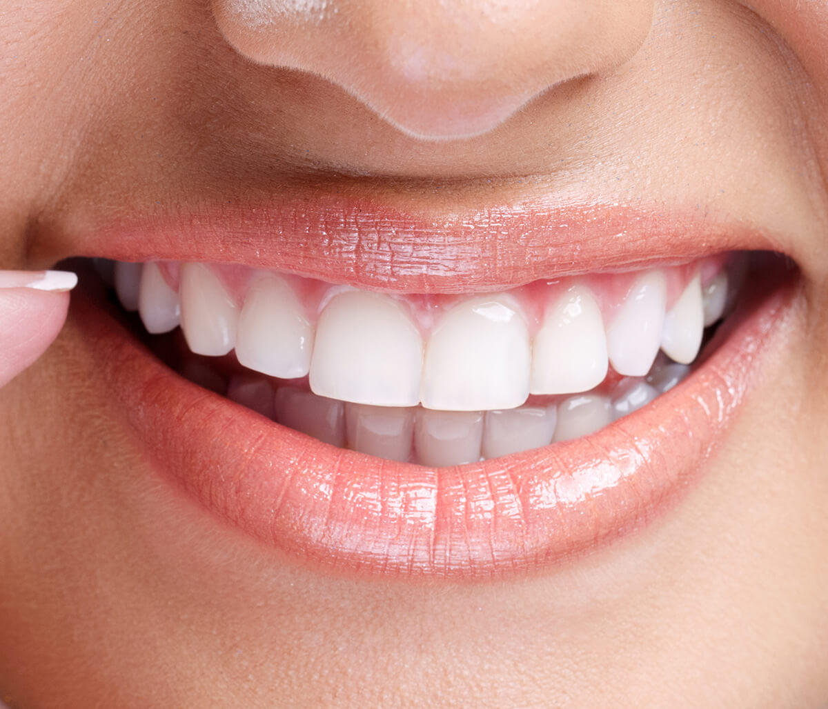 How Long Does Zoom Teeth Whitening in Last Centerville OH Area